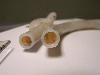 Thick mucus plug causing near-complete ET tube obstruction acute respiratory distress emergent extubation